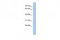 KLHL3 antibody - N-terminal region